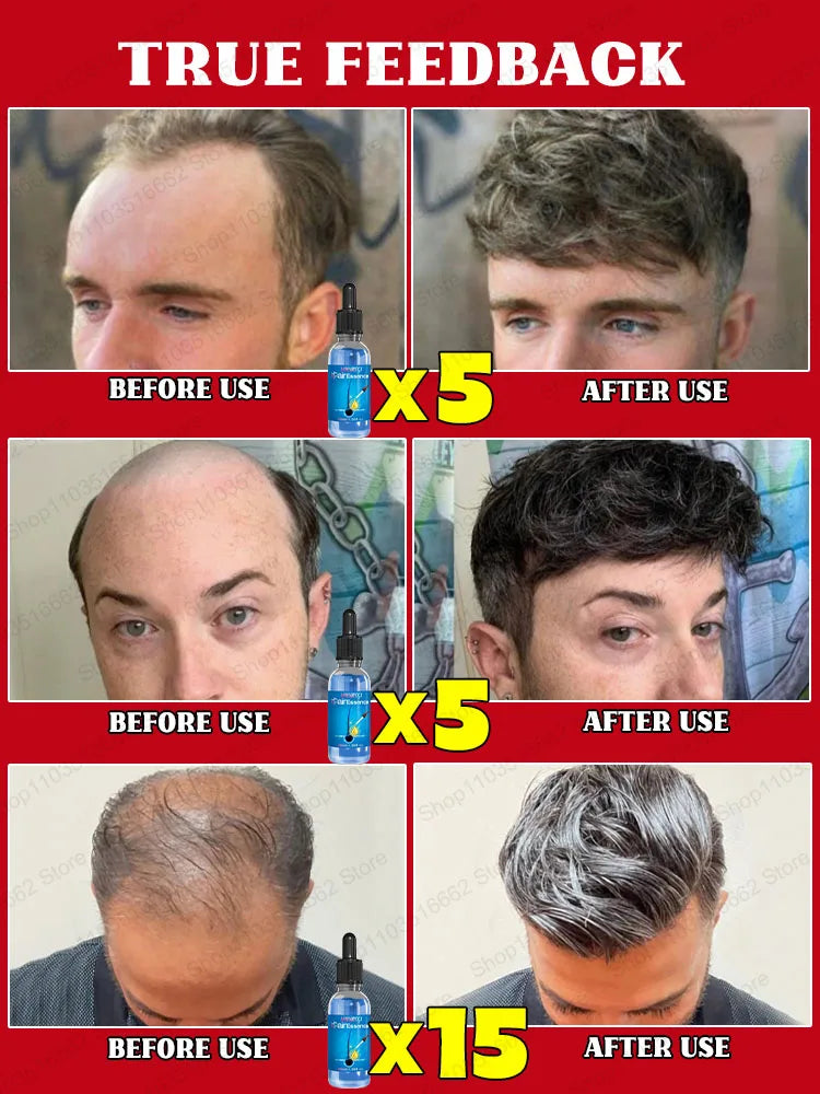 WPRBREGT Hair Growth Essential Oil – Thicker Hair Serum